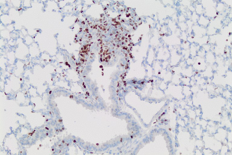 Ki67 positive cells in early KRas driven lung lesion